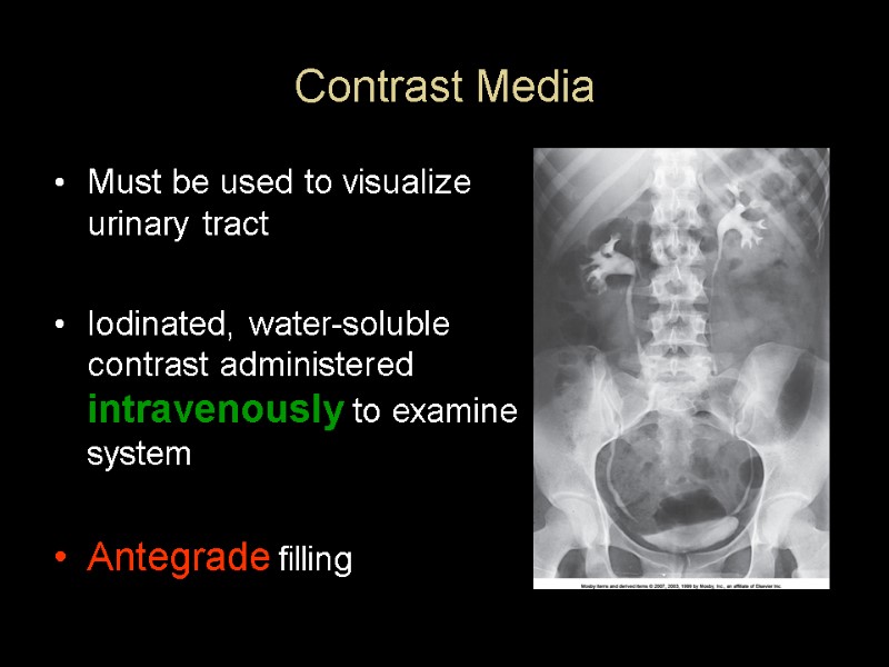 Contrast Media Must be used to visualize urinary tract  Iodinated, water-soluble contrast administered